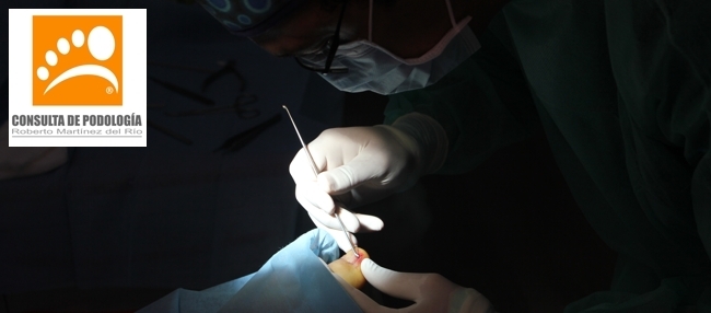 Cirugia Podologica - Consulta de Podologia Roberto Martinez del Rio